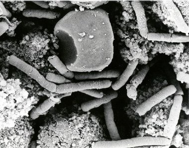 Imagen a microscopía electrónica de la bacteria del Antrax: This image is a work of a U.S. military or Department of Defense employee, taken or made as part of that person's official duties. As a work of the U.S. federal government, the image is in the public domain.