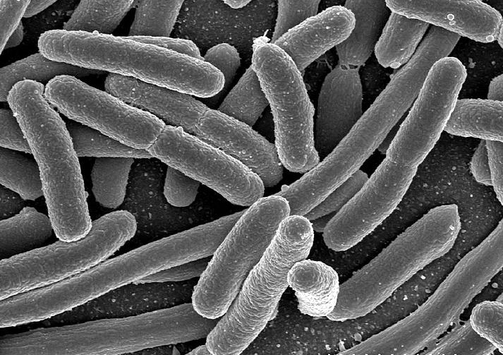 Micrografía al microscopio electrónico de barrido de células de Escherichia coli. Foto: Rocky Mountain Laboratories, NIAID, NIH (DP)