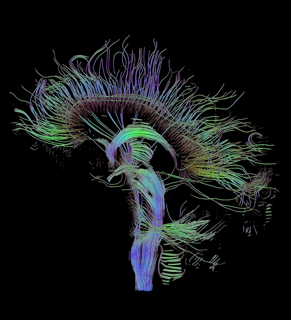 El cerebro, los caminos alucinantes de la comunicación neuronal (Thomas Schultz, CC).
