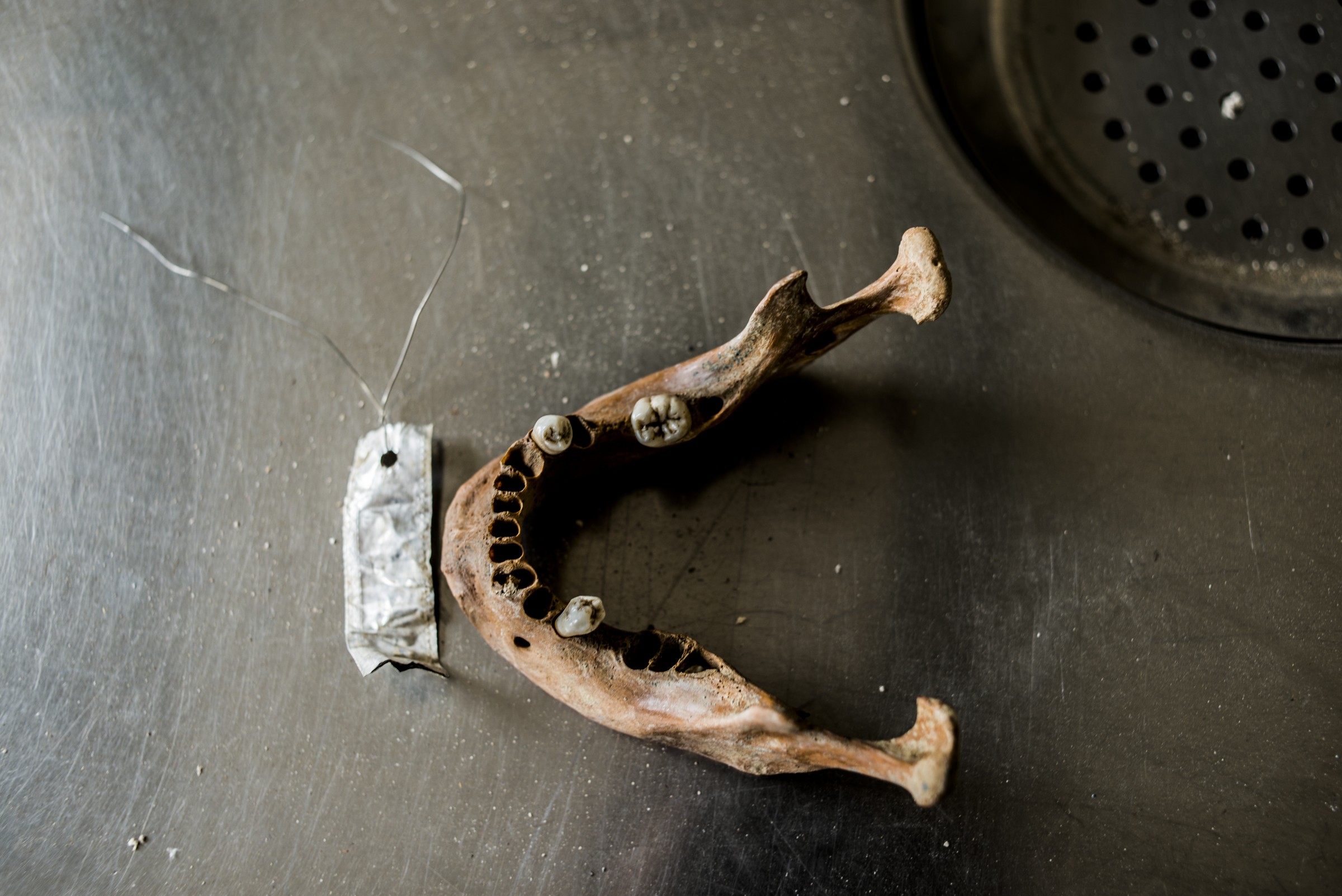 16 Jul 2014, Tuzla, Bosnia and Herzegovina --- A lower jaw bone on a medical table in the ICMP DNA identification facility in Tuzla, Bosnia-Herzegovina. --- Image by © Martyn Aim/Corbis