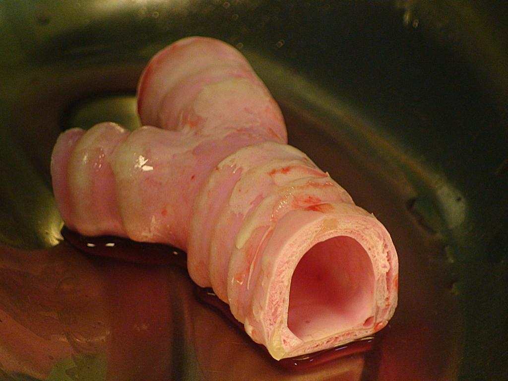 Avances científicos que (casi) pasaron desapercibidos 4 Artificial-Trachea