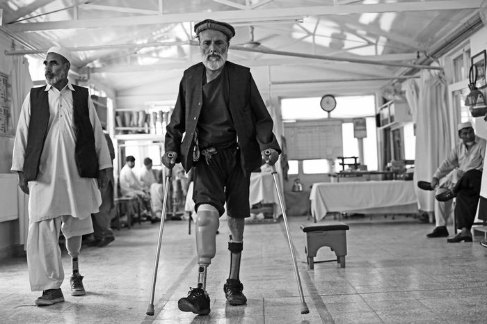 Afganistán aún existe 14 Foto 14 Paciente Ortho en Kabul Serralvo