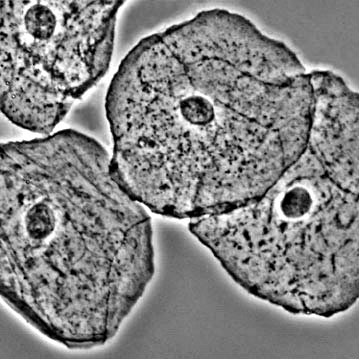 4º Células mucosa bucal