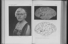 Helen Hamilton Gardener y su cerebro. Imagen: Wellcome Images (CC)
