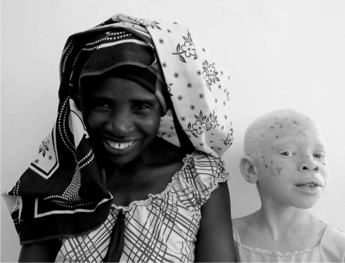 Albinos tanzania Madre y niña sonriente 2p