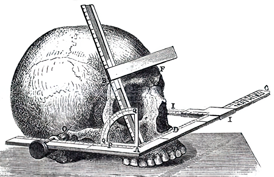 Craniometry gigapixel scale