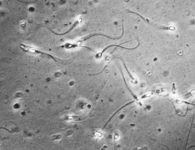 Espermatozoides vistos al microscopio. DP. el mundo invisible