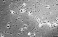 Espermatozoides vistos al microscopio. DP. el mundo invisible